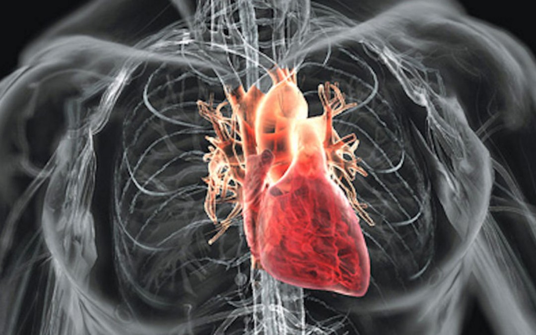 Heart Disease and Stroke