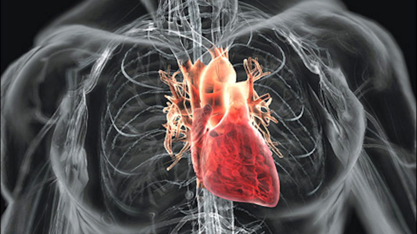 Heart Disease and Stroke