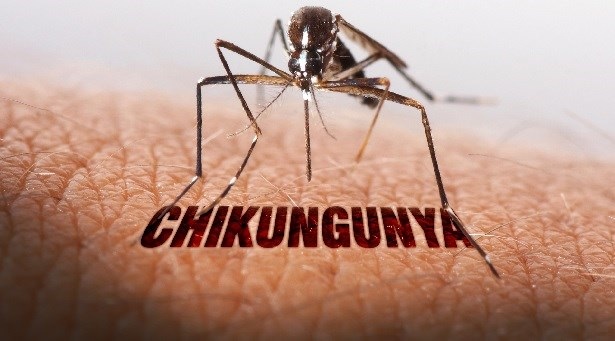 Chikungunya – Prevention & Natural Treatment