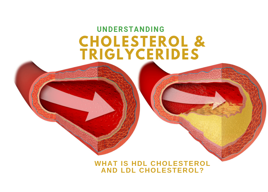Understanding Cholesterol, Triglycerides, HDL Cholesterol and LDL Cholesterol