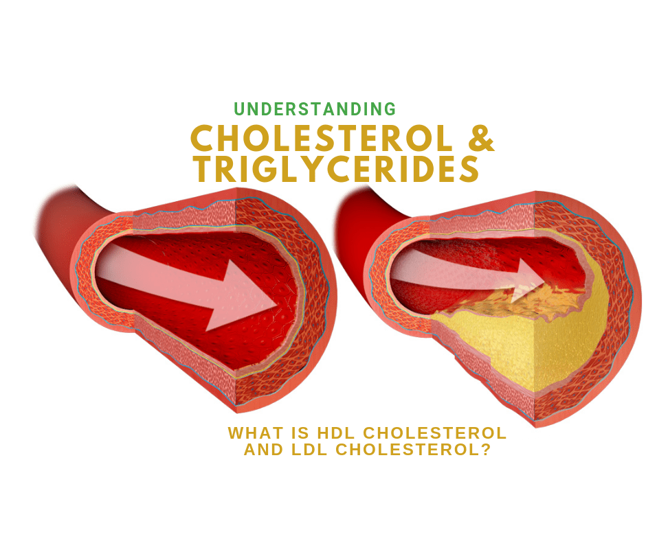 Understanding Cholesterol, Triglycerides, HDL Cholesterol and LDL Cholesterol