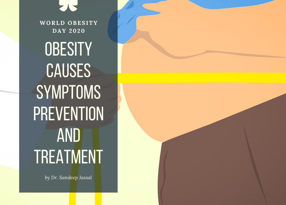 Obesity: Lifestyle, Symptoms, Causes, Risk, Treatment & Diet