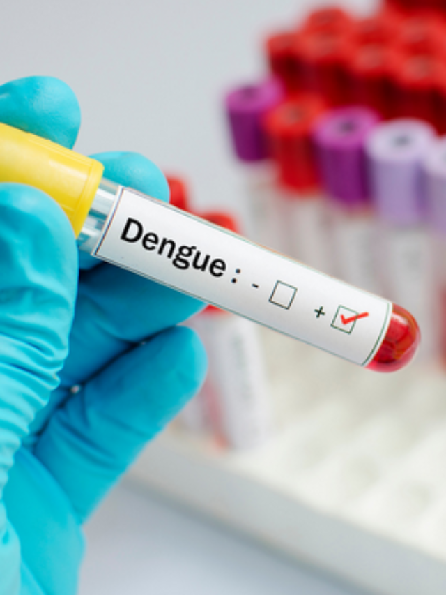 7 Foods You Must Eat To Recover Faster From Dengue